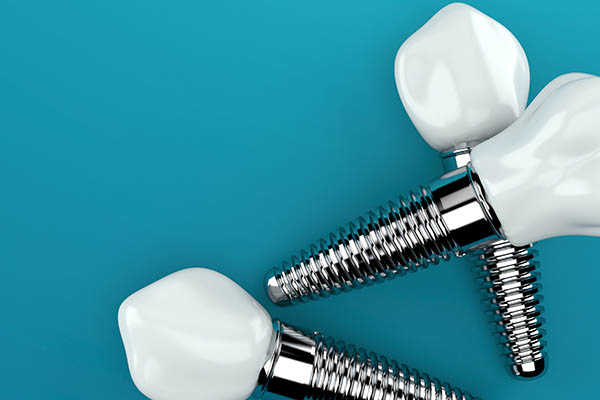 Discover The Lifelong Benefits Of A Dental Implant For Your Oral Health