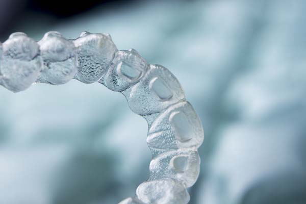 When To Choose Invisalign Over Traditional Braces